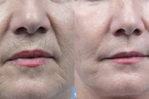 IMG_20260119_231526_822