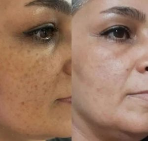 IMG_20260122_105233_700