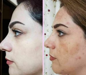 IMG_20260127_020909_772 (1)