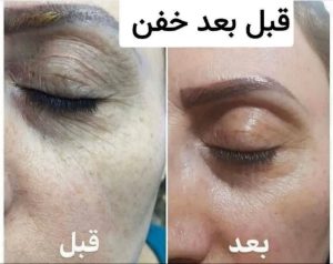 IMG_20260201_073028_955 (1)